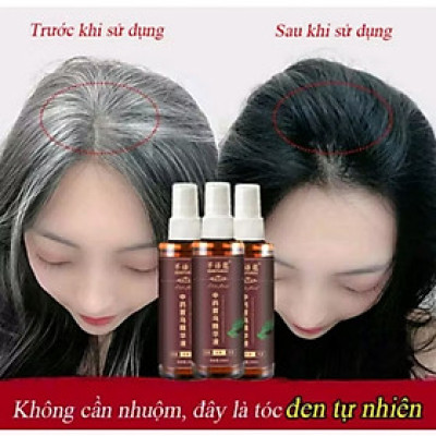 1 CHAI TINH DẦU THẢO MỘC XỊT ĐEN TÓC BÓNG MƯỢT ĐẸP
