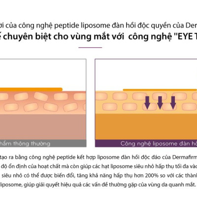 Kem xóa nhăn và giảm thâm vùng mắt Dermafirm Bio Eye Concentrate Cream 15ml