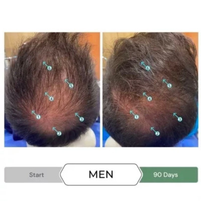Dầu xả chống oxy hóa, kích thích mọc tóc REVITA.CBD CONDITIONER 205ML
