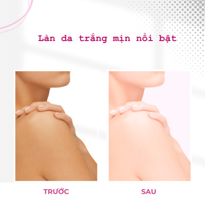 Kem Dưỡng Thể Trắng Da Nâng Tone Tăng Cường POP