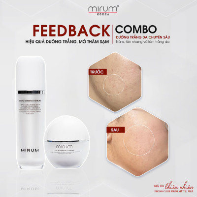Tinh Chất dưỡng trắng da #Nám, #Tàn_Nhang & Làm_Trắng Da Mirum 45ml – Mirum Glow Synergy Serum