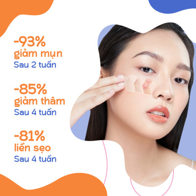 Kem chấm mụn rau má Oribe giảm mụn mờ thâm ngăn ngừa sẹo mụn 20g