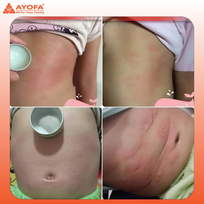 Cao Xoa Bóp Massage Thảo Dược Giúp Phục Hồi Và Làm Dịu Nhanh Chóng Ayofa Relax Hương Gừng 20G