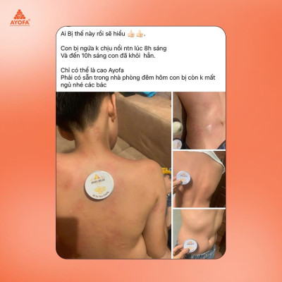 Cao Xoa Bóp Massage Thảo Dược Giúp Phục Hồi Và Làm Dịu Nhanh Chóng Ayofa Relax Hương Chanh 20G