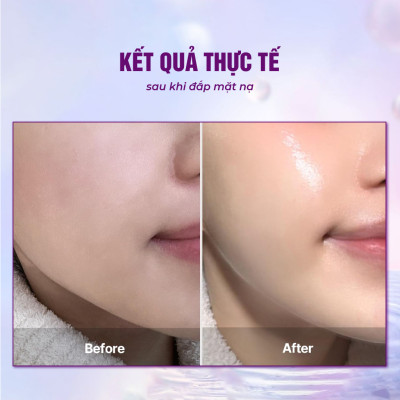 Combo 3 Mặt nạ BESKINATY Glutathione Bio Mask dưỡng sáng phục hồi da cao cấp