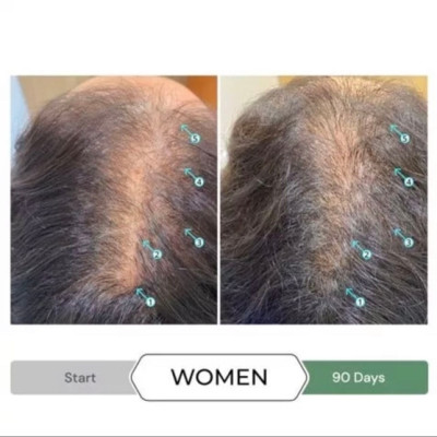 Dầu xả chống oxy hóa, kích thích mọc tóc REVITA.CBD CONDITIONER 205ML