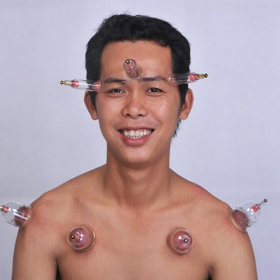 Bộ Giác Hơi Không Dùng Lửa Duy Thành YGH02