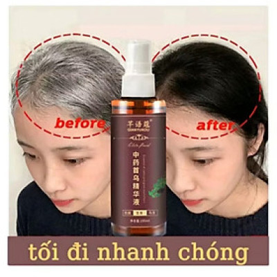 CHAI TINH DẦU THẢO MỘC XỊT ĐEN TÓC BÓNG MƯỢT ĐẸP TÓC TRẮNG THÀNH TÓC ĐEN DƯỠNG TÓC CAO CẤP 
