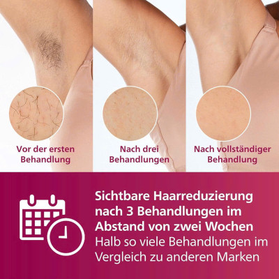 Máy Triệt Lông Philips Lumea Advanced IPL BRI923 hàng chính hãng