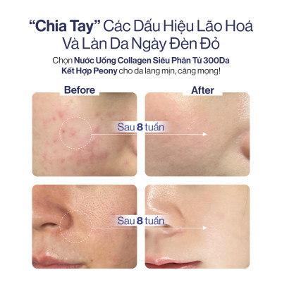 NƯỚC UỐNG COLLAGEN GILAA SIÊU PHÂN TỬ 300DA GILAA KẾT HỢP PEONY TRẺ HÓA CÂN BẰNG NỘI TIẾT (20g x 15 gói)