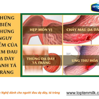 Sữa nghệ curcumin 800g TOPTEN Milk sữa bột cho người bị đau dạ dày tá tràng,phụ nữ sau sinh ,đẹp da